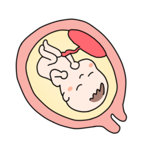 エコチル調査データを用いた癒着胎盤のリスク因子についての検討